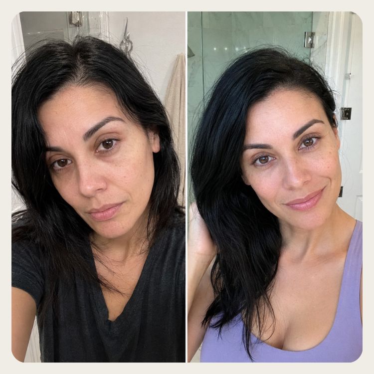 NIMALOU Lumis™ — 3 in 1 Augenlifter