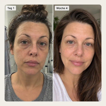 NIMALOU Lumin™ — Rotlicht & EMS Augenlifter