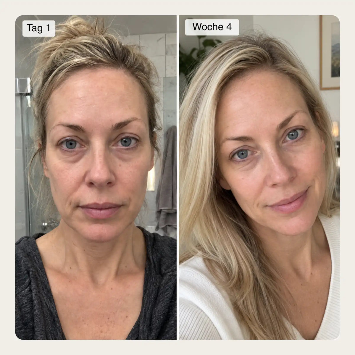 NIMALOU Lumin™ — Rotlicht & EMS Augenlifter