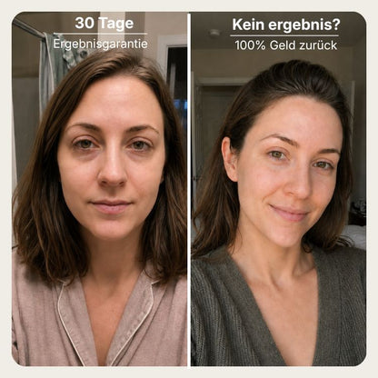 NIMALOU Lumis™ — 3 in 1 Augenlifter