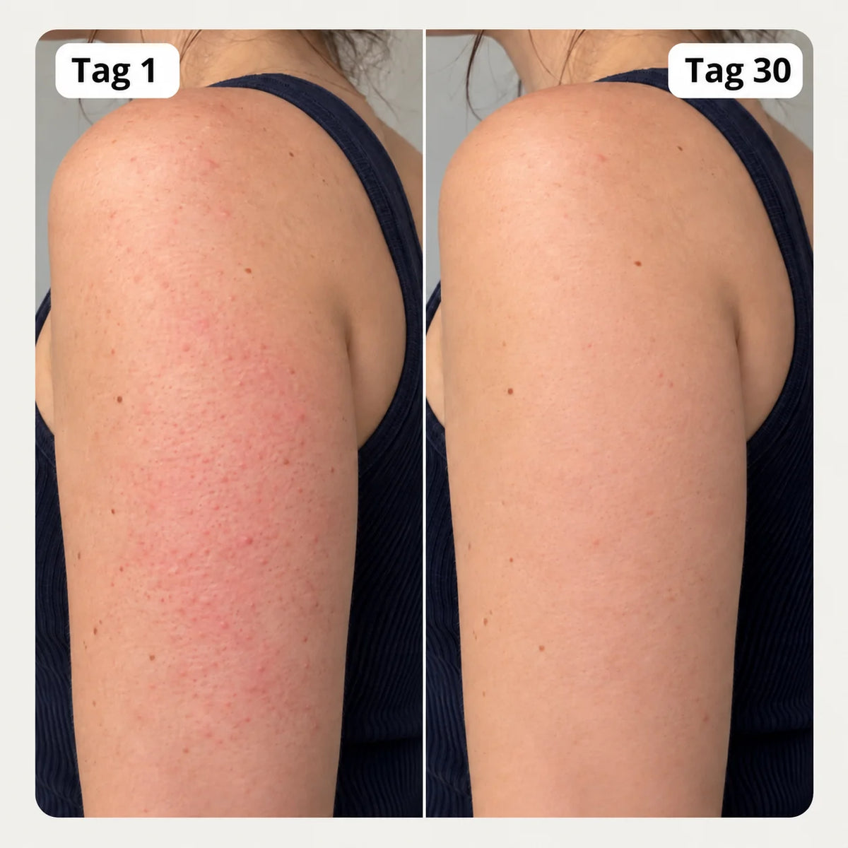 NIMALOU Pure™  Filterduschkopf